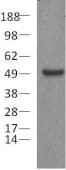 PathPlus™ PAX5 Antibody (clone 1H9)
