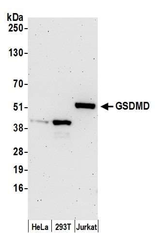 Gasdermin D / GSDMD Antibody (aa434-484)