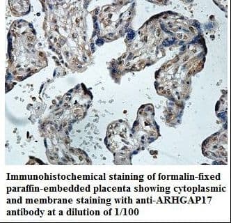 ARHGAP17 / NADRIN Antibody (aa2-195)