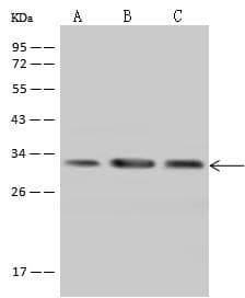 Polyclonal Rabbit anti-Human PECR Antibody (IHC, IF, WB)