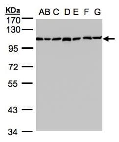 GANAB / Alpha Glucosidase II Antibody (aa47-251)