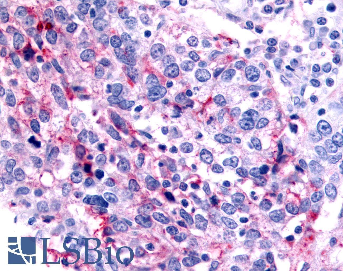 PathPlus™ Polyclonal Rabbit anti-Human NR0B2 Antibody (Ligand-binding Domain, IHC, IF)