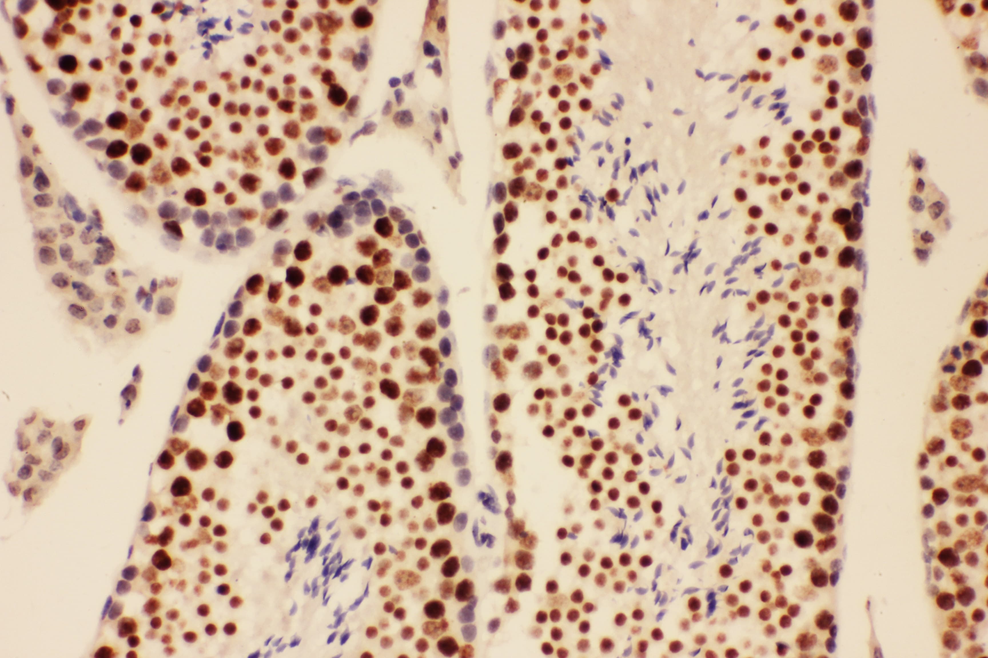 BRCA1 Antibody (aa1661-1863)