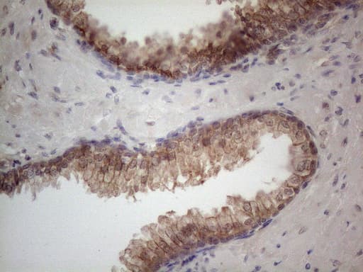 Monoclonal Mouse anti-Human MTF-1 Antibody (clone OTI2F3, aa1-272, IHC, WB)