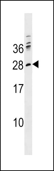 Polyclonal Rabbit anti-Human PTCRA Antibody (aa197-225, WB)