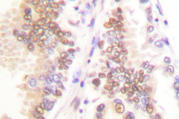 Polyclonal Rabbit anti-Human SKP2 Antibody (Pro399, IHC, IF, WB)