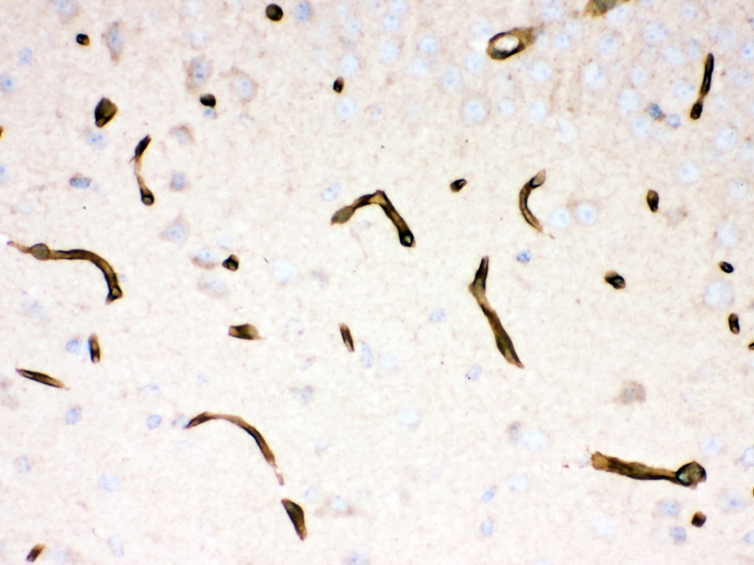 DMD / Dystrophin Antibody (aa3076-3404)