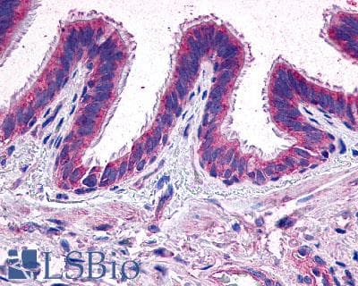 IHC-plus™ PTGER2 / EP2 Antibody (Extracellular Domain)