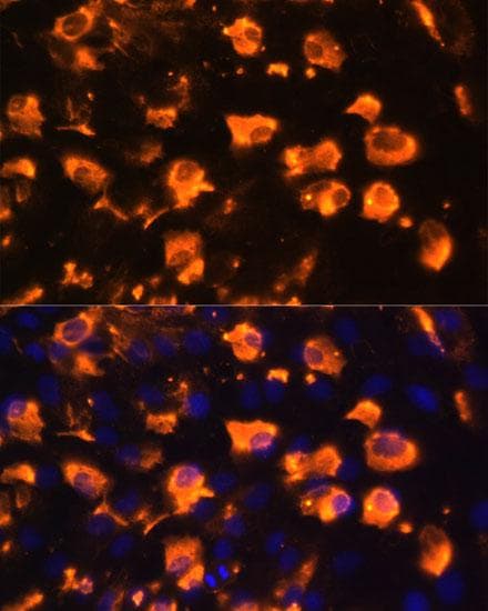 JAG2 / Jagged-2 Antibody
