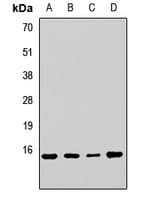 Polyclonal Rabbit anti-Human RPL23 / Ribosomal Protein L23 Antibody (WB)