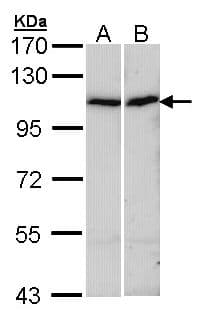 ACTN4 Antibody (aa206-542)