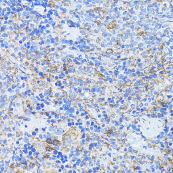 Polyclonal Rabbit anti-Human ARRB1 / Beta Arrestin 1 Antibody (IHC, IF, WB)