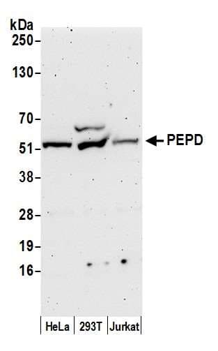 PEPD / PROLIDASE Antibody (aa443-493)