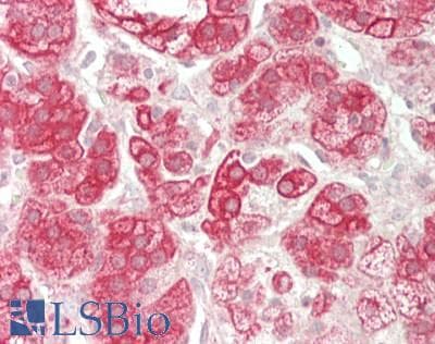 IHC-plus™ PPFIBP1 Antibody (aa588-617)