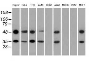 Basigin / Emmprin / CD147 Antibody (clone OTI4D3)