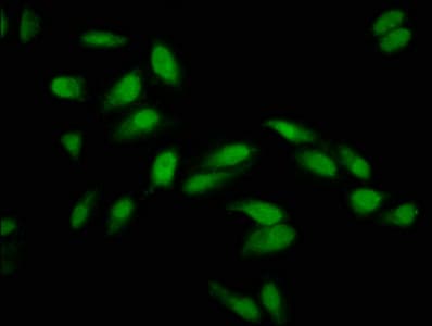 NSPC1 / PCGF1 Antibody