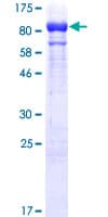Human GBP1 Protein (Recombinant GST)