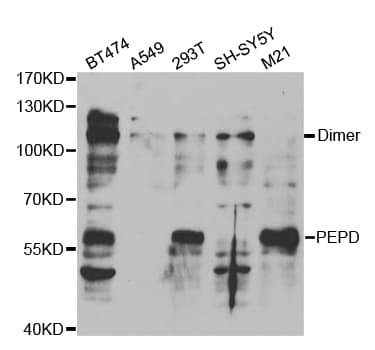 PEPD / PROLIDASE Antibody