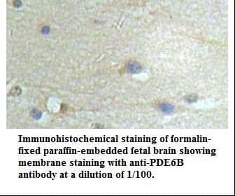 PDE6B / PDE6 Beta Antibody