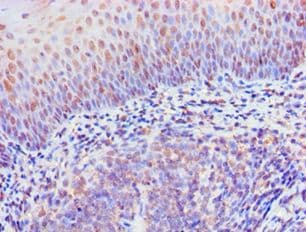 RIPK3 / RIP3 Antibody (aa1-120)