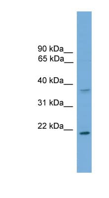 GSTM1 Antibody (C-Terminus)