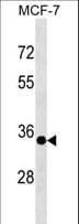 EPSTI1 Antibody (aa15-41)