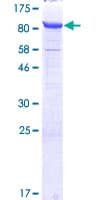 Human NUB1 Protein (Recombinant GST)