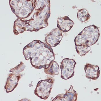 KRT18 / CK18 / Cytokeratin 18 Antibody