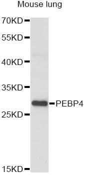 Polyclonal Rabbit anti-Human PEBP4 Antibody (WB)
