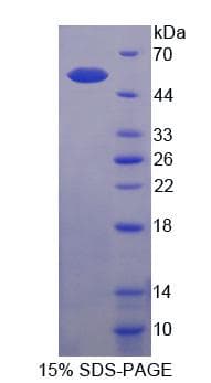 Mouse PA26 / SESN1 Protein (Recombinant His-T7)