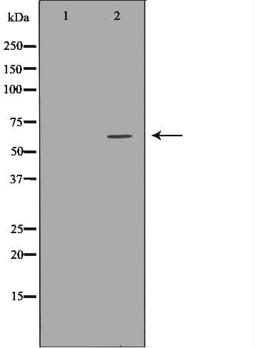ASNS Antibody