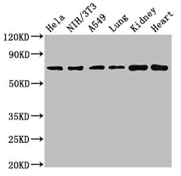 Polyclonal Rabbit anti-Human ARHGAP18 Antibody (IHC, WB)