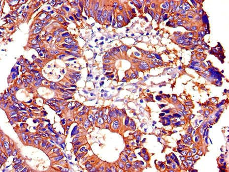 Polyclonal Rabbit anti-Human ATP1A1 Antibody (IHC, IF)