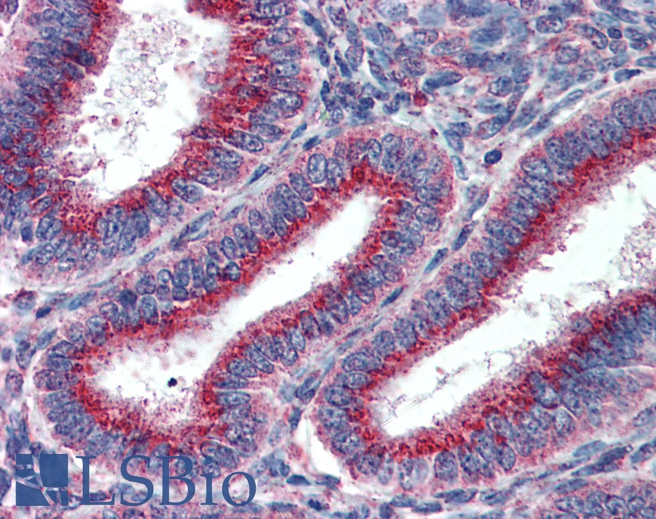 IHC-plus™ Monoclonal Mouse anti-Human US01 / p115 Antibody (clone 3F4, IHC, WB)