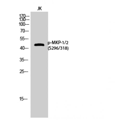 DUSP1 + DUSP4 Antibody (230-310 aa)