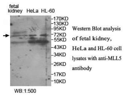 KMT2E / MLL5 Antibody (aa298-490)