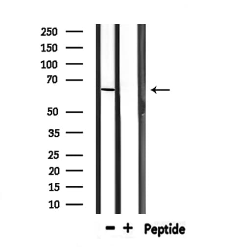 Polyclonal Rabbit anti-Human PTBP1 Antibody (IHC, WB)