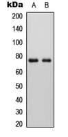 PLAP / Alkaline Phosphatase Antibody (N-Terminus)