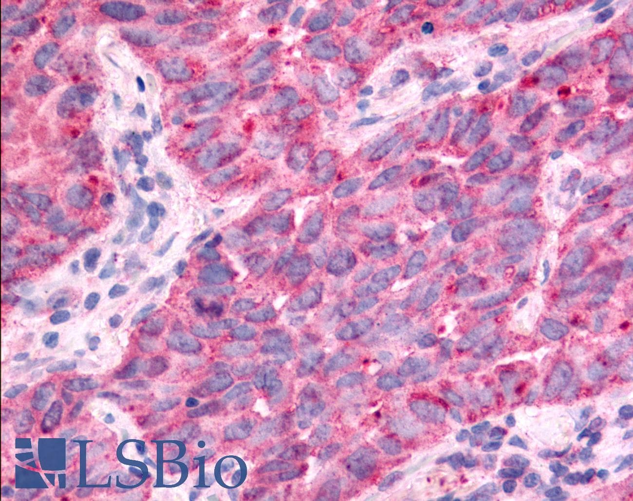 PathPlus™ TAOK1 / TAO1 Antibody (Internal)