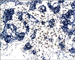 CD8A / CD8 Alpha Antibody