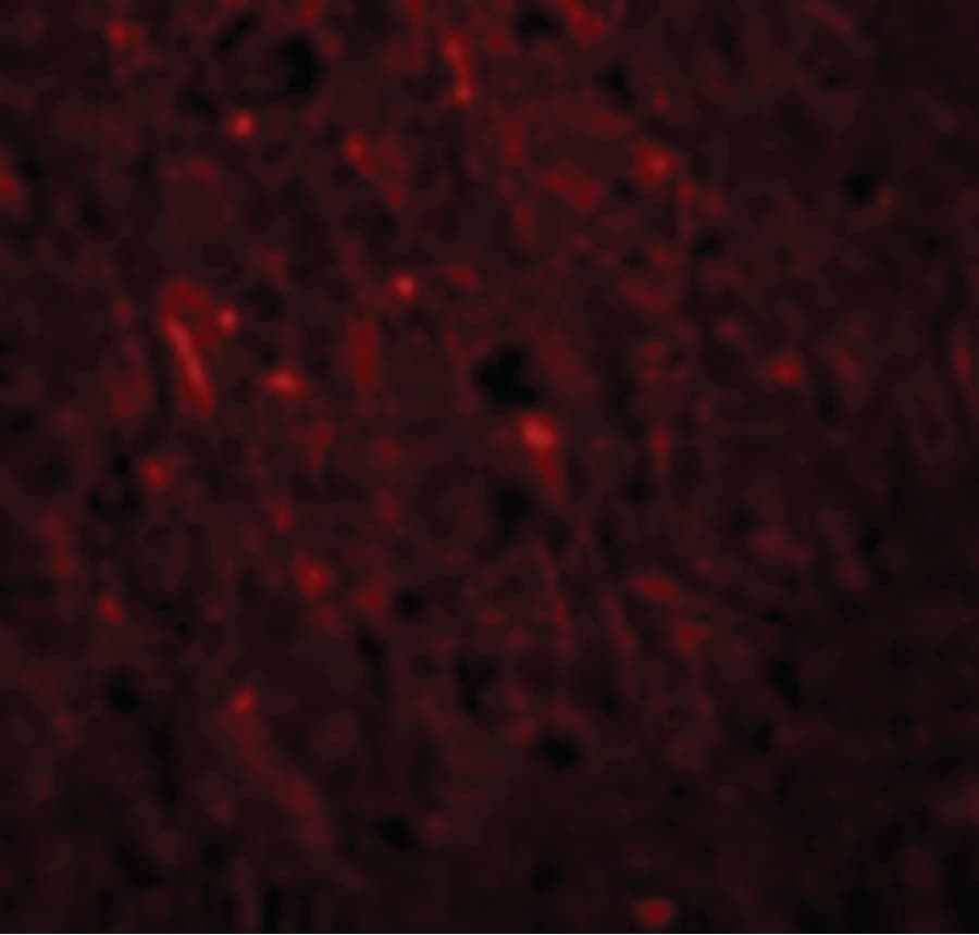 IHC-plus™ Polyclonal Rabbit anti-Human PLEKHM2 / SKIP Antibody (IHC, IF, WB)