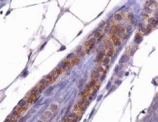 CTG-B45d / THAP11 Antibody