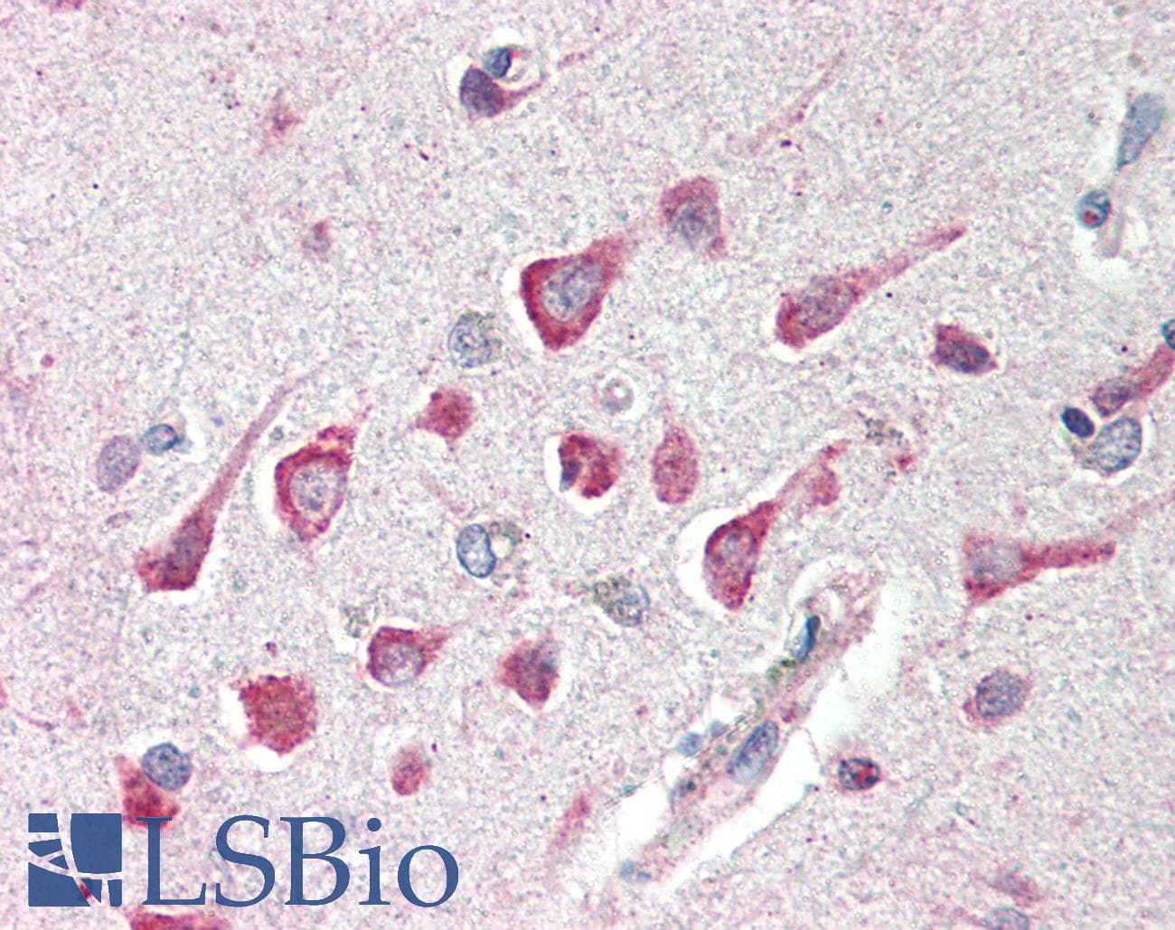 IHC-plus™ Polyclonal Rabbit anti-Human C1QTNF4 / CTRP4 Antibody (IHC, IF, WB)