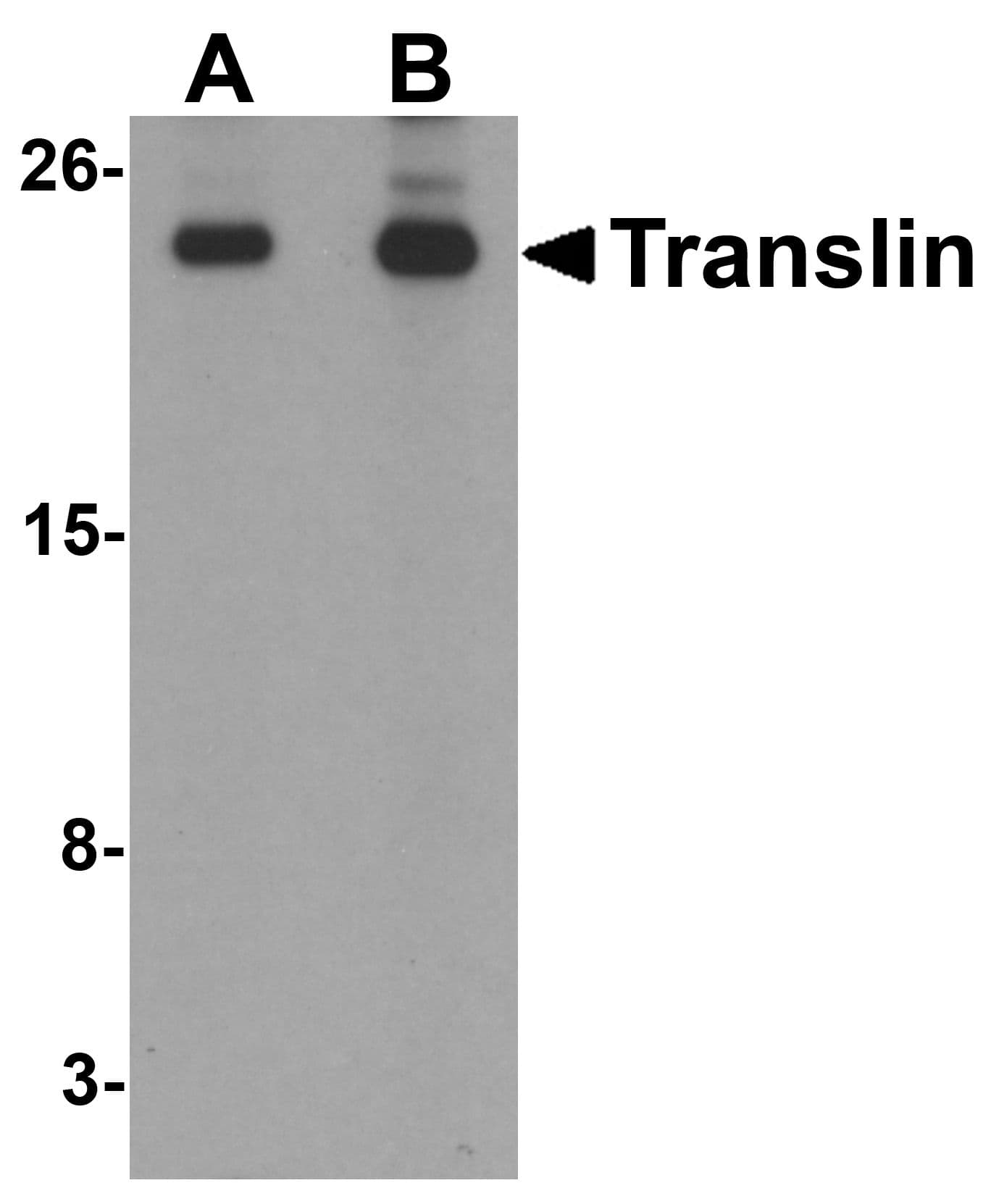 IHC-plus™ TSN / Translin Antibody