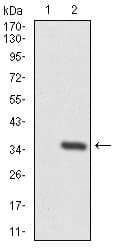 TWF1 / PTK9 Antibody (clone 7C11)