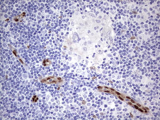 MEOX1 Antibody (clone OTI5B11)