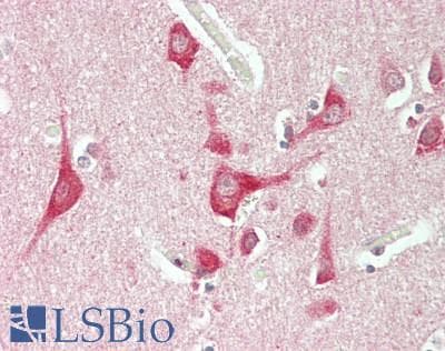 IHC-plus™ Polyclonal Rabbit anti-Human DNAJA4 Antibody (IHC, WB)