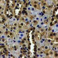 USP7 / HAUSP Antibody