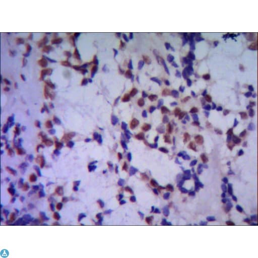 TBL1XR1 / TBLR1 Antibody