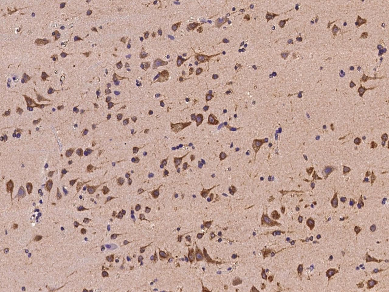 COPG / Gamma-COP Antibody